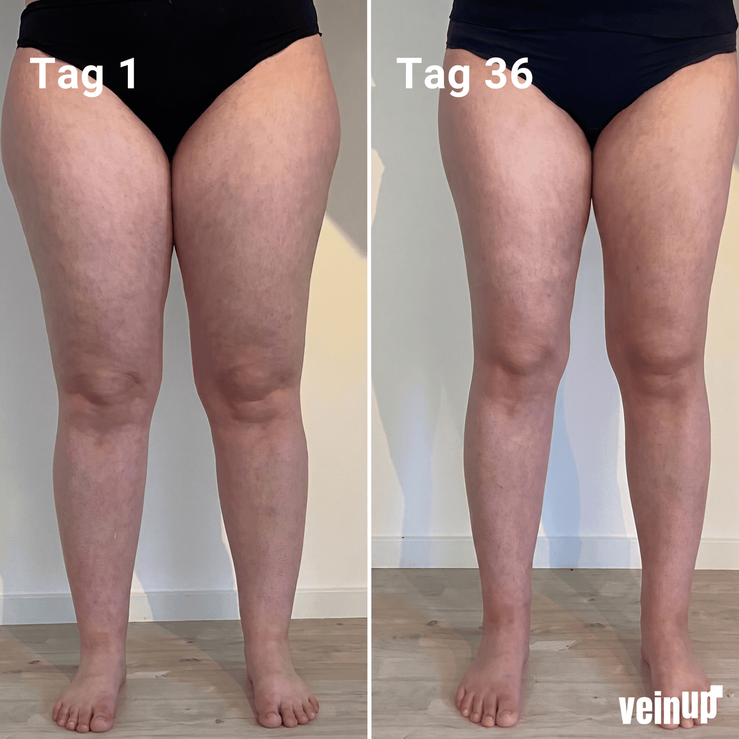 VeinFlex Pro Kompressionsleggings