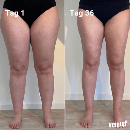 VeinFlex Pro Kompressionsleggings